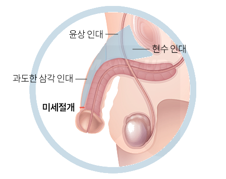 오감만족 복합수술에 포함되는 처치