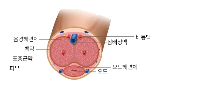 가장자리 라운딩과 다공 기법