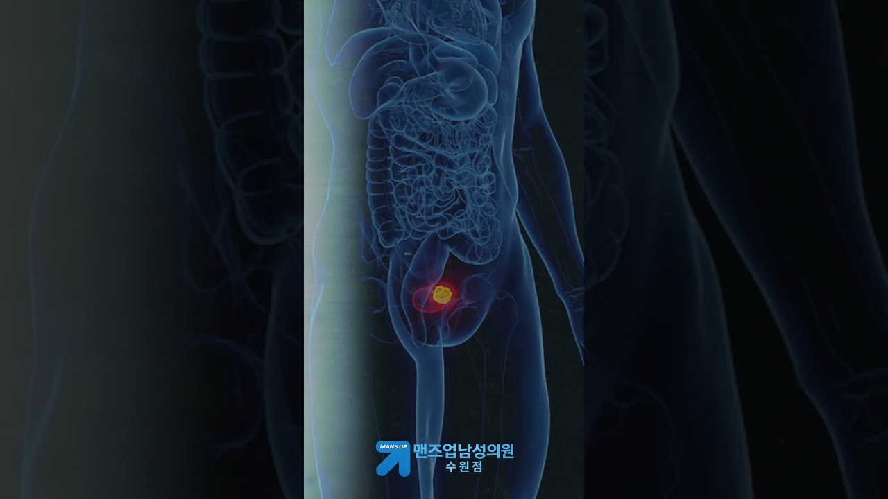 남성확대수술 종류·회복기간·부작용, 상담 전 꼭 물어볼 3가지